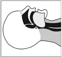 Рис. 58. При расслаблении мышц шеи язык закрывает вход в дыхательное горло